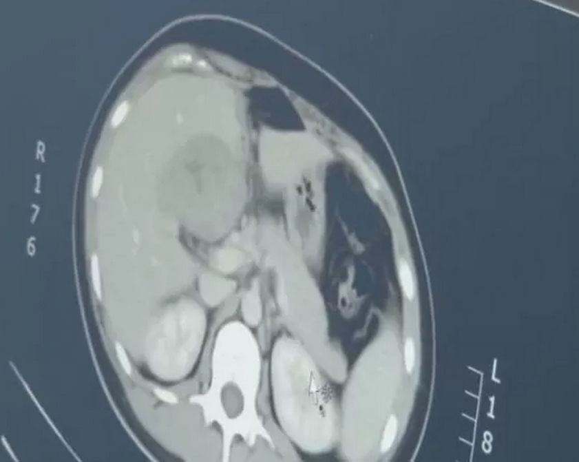 空孕囊的十個(gè)征兆，早期識(shí)別與應(yīng)對(duì)，空孕囊的十個(gè)征兆，早期識(shí)別與應(yīng)對(duì)策略