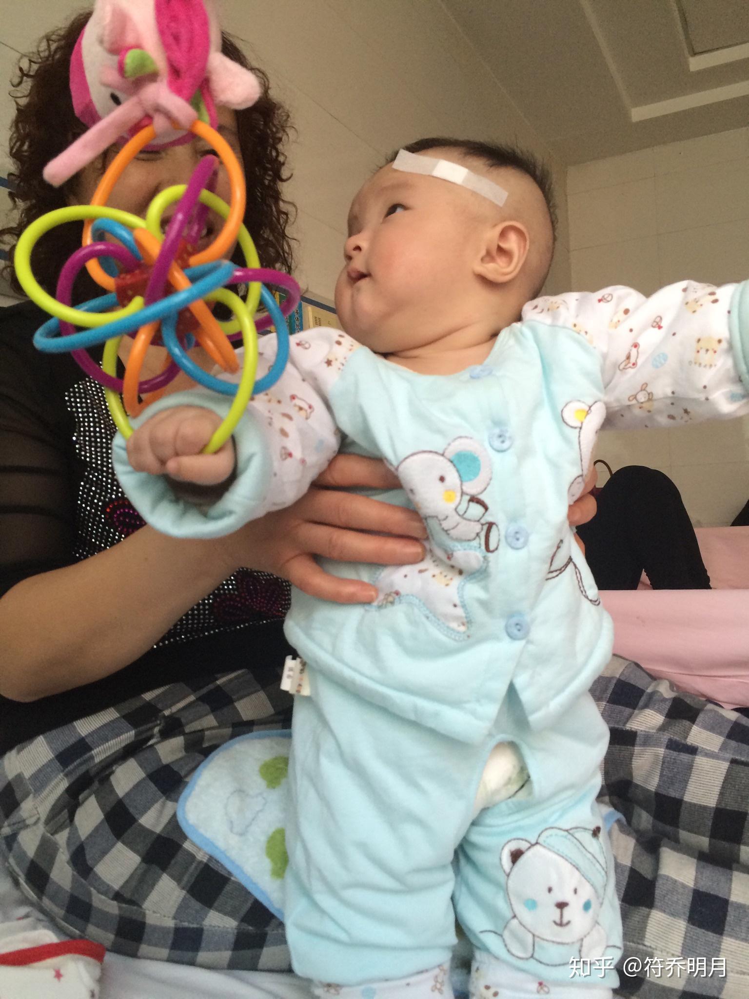 二個(gè)月嬰兒腦癱最明顯的特征，二個(gè)月嬰兒腦癱最明顯的特征表現(xiàn)