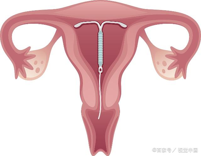 常見八種陰型照片及其特點(diǎn)解析，常見八種陰型照片特點(diǎn)深度解析