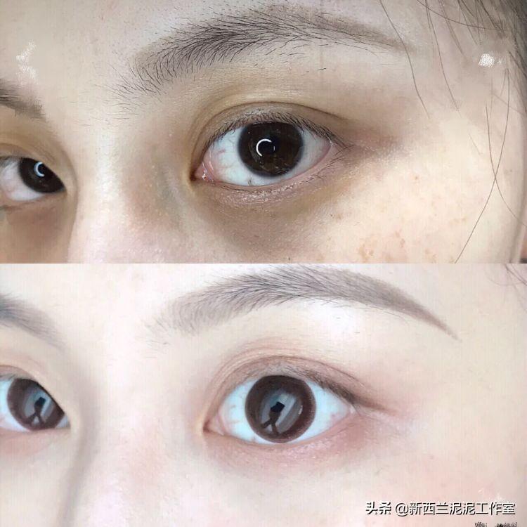 眼紋嚴(yán)重？快速有效的去眼紋方法大揭秘，揭秘快速有效的去眼紋方法，告別眼部皺紋煩惱！