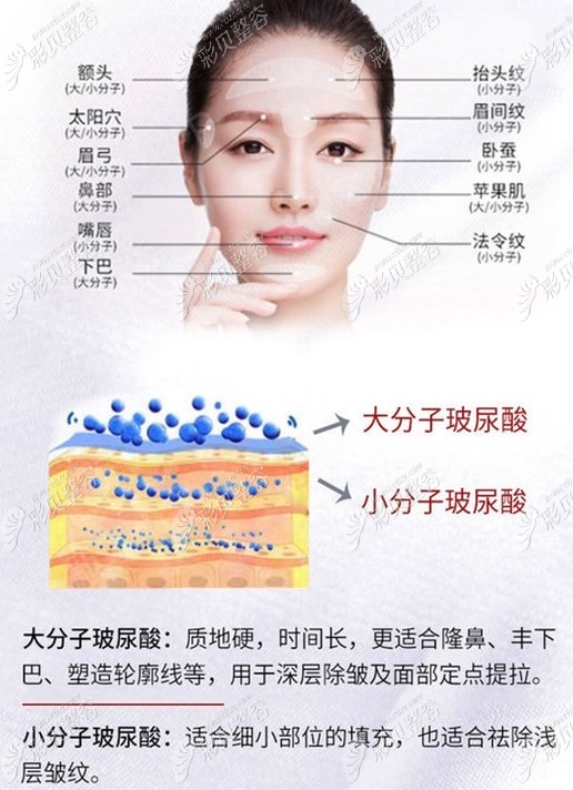 玻尿酸的作用與功效，深入了解玻尿酸的奧秘，玻尿酸的作用與功效揭秘，深入了解玻尿酸的神奇之處