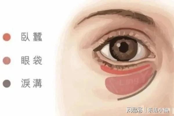 眼袋切除手術(shù)費(fèi)用詳解，價格因素與如何選擇合適的手術(shù)方案，眼袋切除手術(shù)費(fèi)用解析，了解價格因素與選擇最佳手術(shù)方案