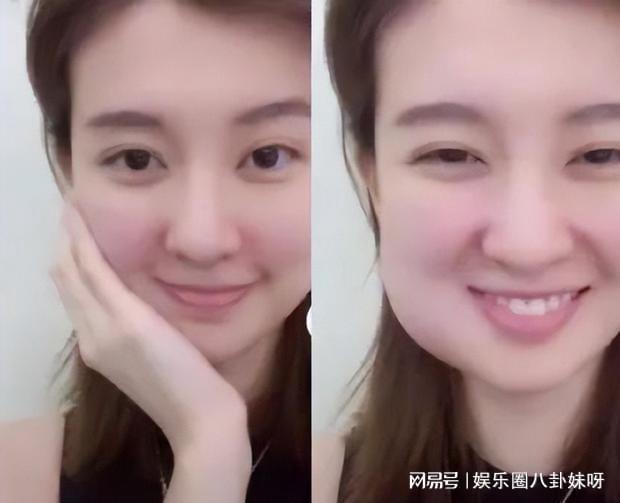 智齒被肉包住了一定要拔嗎？解讀智齒包埋現(xiàn)象及其處理方式，解讀智齒包埋現(xiàn)象，智齒被肉包住是否需要拔除？