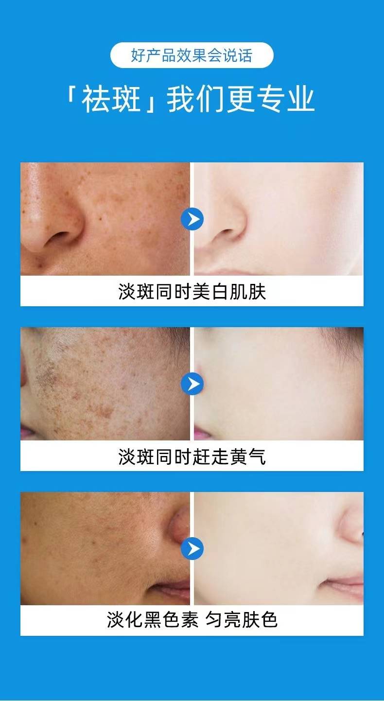 揭秘祛斑最佳方法，如何達到最佳祛斑效果？，揭秘最佳祛斑方法，實現(xiàn)最佳效果的秘訣！