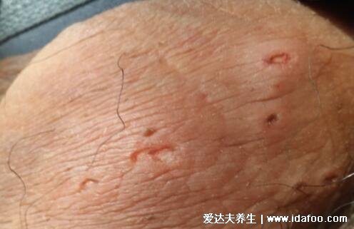 得性疾病前兆，了解、預(yù)防與應(yīng)對，得性疾病的早期信號，了解、預(yù)防與應(yīng)對策略